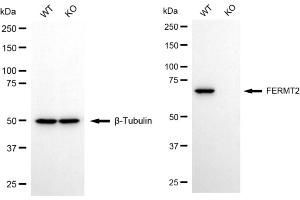 Western blotting analysis using FERMT2 antibody (ABIN7798593).