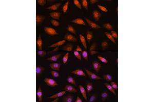Immunofluorescence analysis of L929 cells using LIMK2 Rabbit pAb (ABIN6128187, ABIN6143230, ABIN6143231 and ABIN6221057) at dilution of 1:100 (40x lens). (LIMK2 antibody  (AA 1-240))