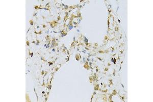 Immunohistochemistry of paraffin-embedded human lung using RPL13 antibody (ABIN1682571, ABIN5664631, ABIN5664633 and ABIN6220492) at dilution of 1:100 (40x lens). (RPL13 antibody  (AA 1-211))