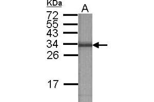 Image no. 2 for anti-ATPase, H+ Transporting, Lysosomal 31kDa, V1 Subunit E2 (ATP6V1E2) antibody (ABIN1502161)