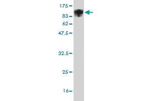 Western Blot detection against Immunogen (98. (ALOX15 antibody  (AA 1-662))