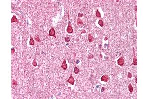 anti-Solute Carrier Family 18 (Vesicular Monoamine Transporter), Member 1 (SLC18A1) (C-Term) antibody