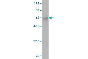 Western Blot detection against Immunogen (58. (FBXO22 antibody  (AA 1-299))