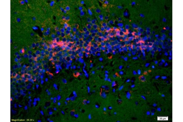 Nicastrin antibody  (AA 21-120)