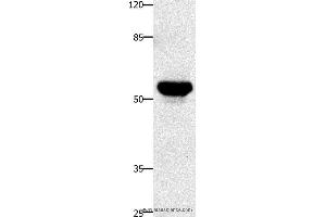 Western blot analysis of Human fetal brain tissue, using TNFRSF21 Polyclonal Antibody at dilution of 1:420 (TNFRSF21 antibody)