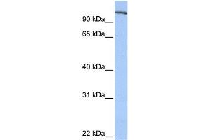 WB Suggested Anti-FES Antibody Titration: 0. (FES antibody  (N-Term))