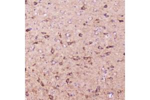 IHC testing of FFPE mouse brain tissue with IGFBP2 antibody at 2ug/ml. (IGFBP2 antibody  (AA 35-304))