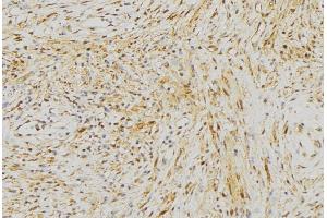 ABIN6272968 at 1/100 staining Mouse muscle tissue by IHC-P. (NLRX1 antibody  (Internal Region))