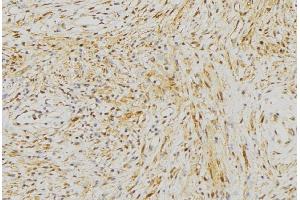 ABIN6272968 at 1/100 staining Mouse muscle tissue by IHC-P. (NLRX1 antibody  (Internal Region))
