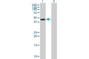 Western Blot analysis of SERPINB3 expression in transfected 293T cell line by SERPINB3 MaxPab polyclonal antibody. (SERPINB3 antibody  (AA 1-390))