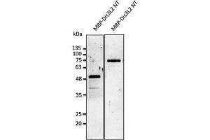 Western Blotting (WB) image for anti-DIS3-Like Exonuclease 2 (DIS3L2) (N-Term) antibody (ABIN7272981) (DIS3L2 antibody  (N-Term))