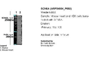 WB Suggested Anti-SCN5A Antibody Titration: 0.