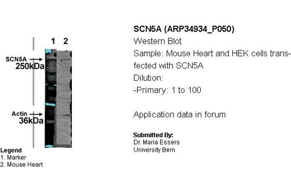 SCN5A Antikörper  (N-Term)