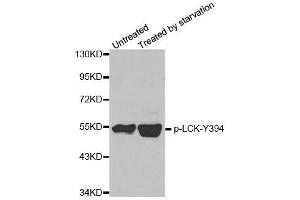 Western blot analysis of extracts from JK cells, using phospho-LCK-Y394 polyclonal antibody (ABIN2987539). (LCK antibody  (pTyr394))
