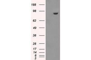 Image no. 1 for anti-Glucan (1,4-alpha-), Branching Enzyme 1 (GBE1) antibody (ABIN1498396) (GBE1 antibody)