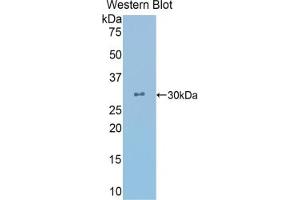 Detection of Recombinant CRYl1, Human using Polyclonal Antibody to Crystallin Lambda 1 (CRYl1) (CRYL1 antibody  (AA 24-232))