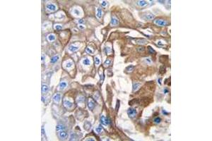 Image no. 2 for anti-GTPase NRas (NRAS) (C-Term) antibody (ABIN360039) (GTPase NRas antibody  (C-Term))