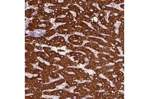 Immunohistochemical staining (Formalin-fixed paraffin-embedded sections) of human liver with CES1 polyclonal antibody  shows strong cytoplasmic positivity in hepatocytes. (CES1 antibody)