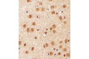 Immunohistochemical analysis of paraffin-embedded M. (SIRT1 antibody  (C-Term))