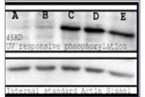 Image no. 1 for anti-Phosphoserine (phosphorylated) antibody (ABIN264875) (Phosphoserine antibody  (phosphorylated))