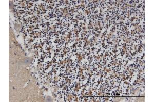 Immunoperoxidase of monoclonal antibody to PDE9A on formalin-fixed paraffin-embedded human cerebellum. (PDE9A antibody  (AA 434-533))