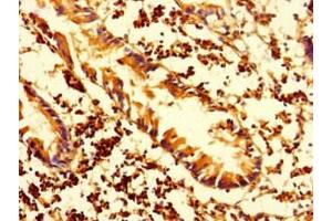 Immunohistochemistry of paraffin-embedded human appendix tissue using ABIN7155576 at dilution of 1:100 (HLA-DMA antibody  (AA 27-233))