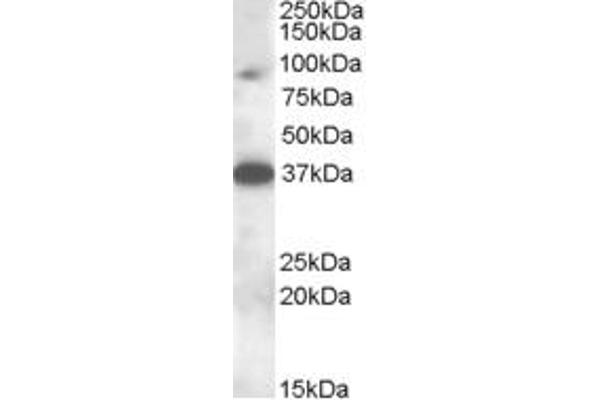 MARCH10 antibody  (Internal Region)