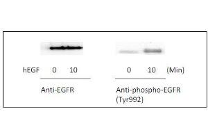 Western blot analysis of extracts from 100 ng/mL hEGF treated A431 cells. (EGFR ELISA Kit)