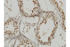 Immunoperoxidase of monoclonal antibody to KPNA1 on formalin-fixed paraffin-embedded human testis. (KPNA1 antibody  (AA 1-538))