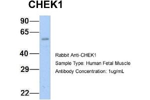 Host: Rabbit Target Name: CHEK1 Sample Type: Human Fetal Muscle Antibody Dilution: 1. (CHEK1 antibody  (Middle Region))