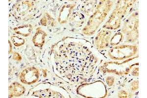 IHC image of ABIN7146841 diluted at 1:200 and staining in paraffin-embedded human kidney tissue performed on a Leica BondTM system. (CPT2 antibody  (AA 388-551))