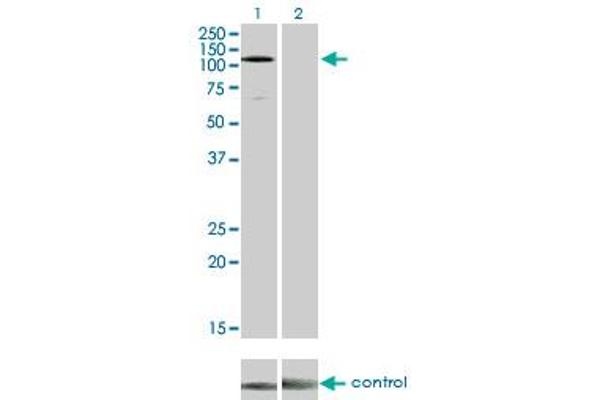 EPH Receptor A3 antibody  (AA 202-326)