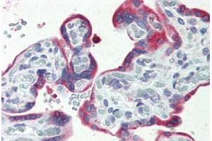 Human, Placenta: Formalin-Fixed Paraffin-Embedded (FFPE) (ERP44 antibody  (C-Term))