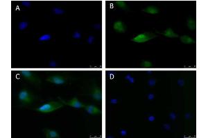 Immunofluorescence of Anti-ATF6 (RABBIT) Antibody Immunofluorescence Microscopy of Rabbit anti-ATF6 antibody.
