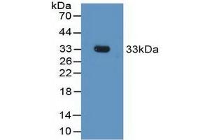 Detection of Recombinant FCN1, Rat using Polyclonal Antibody to Ficolin 1 (FCN1) (FCN1 antibody  (AA 25-279))