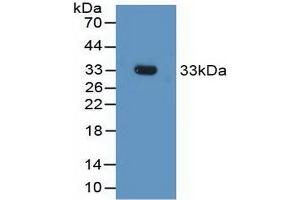 Detection of Recombinant FCN1, Rat using Polyclonal Antibody to Ficolin 1 (FCN1)