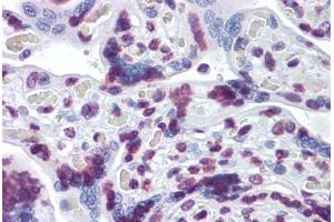Human Placenta: Formalin-Fixed, Paraffin-Embedded (FFPE) (RBM5 antibody  (AA 75-184))