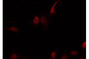 ABIN6267641 staining Hela by IF/ICC. (eIF4EBP1 antibody  (pThr45))
