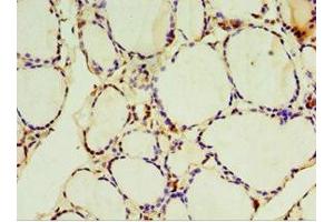 Immunohistochemistry of paraffin-embedded human thyroid tissue using ABIN7170959 at dilution of 1:100 (SULT1C2 antibody  (AA 1-120))