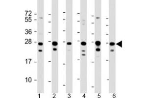 Western blot testing of human 1) HeLa, 2) HepG2, 3) Jurkat, 4) Raji, 5) 293 and 6) 293T/17 cell lysate with PCMT1 antibody at 1:2000. (PCMT1 antibody  (AA 93-126))