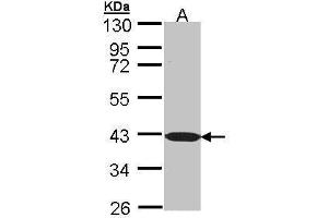 WB Image Sample (30 ug of whole cell lysate) A: Molt-4 , 10 % SDS PAGE antibody diluted at 1:1000 (BEND5 antibody)