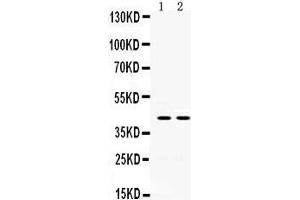 Western Blotting (WB) image for anti-Hydroxysteroid (11-Beta) Dehydrogenase 2 (HSD11B2) (AA 277-309), (C-Term) antibody (ABIN3043846) (HSD11B2 antibody  (C-Term))