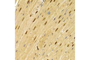 Immunohistochemistry of paraffin-embedded rat heart using CDC25A antibody (ABIN5970519) at dilution of 1/100 (40x lens). (CDC25A antibody)