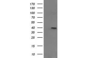 Image no. 1 for anti-PIH1 Domain Containing 2 (PIH1D2) antibody (ABIN1500197) (PIH1D2 antibody)