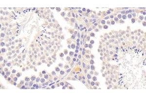 Detection of TIMP2 in Mouse Testis Tissue using Polyclonal Antibody to Tissue Inhibitors Of Metalloproteinase 2 (TIMP2) (TIMP2 antibody  (AA 27-220))