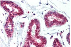 Human Breast (formalin-fixed, paraffin-embedded) stained with PRMT1 antibody ABIN462306 followed by biotinylated goat anti-rabbit IgG secondary antibody ABIN481713, alkaline phosphatase-streptavidin and chromogen. (PRMT1 antibody  (AA 317-346))