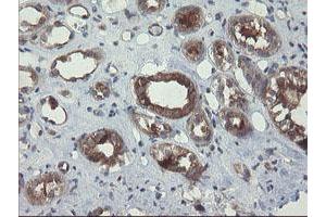 Image no. 2 for anti-Prefoldin Subunit 3 (PFDN3) antibody (ABIN1501705) (VBP1 antibody)