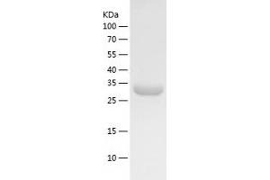 Western Blotting (WB) image for MAK16 Homolog (MAK16) (AA 1-300) protein (His tag) (ABIN7123833) (MAK16 Protein (AA 1-300) (His tag))