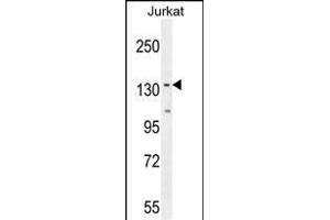 P1R3A Antibody (Center) (ABIN654633 and ABIN2844329) western blot analysis in Jurkat cell line lysates (35 μg/lane).