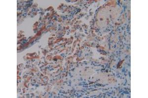IHC-P analysis of Human Lung Tissue, with DAB staining. (FGG antibody  (AA 166-416))